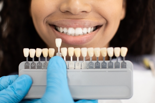 Cosmetic Dentistry in Southfield, MI | Perfect Your Smile With Dental Veneers