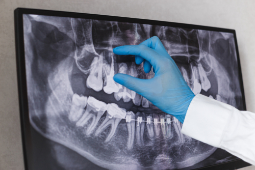 Oral Surgery in Southfield, MI | Schedule a Free Consultation