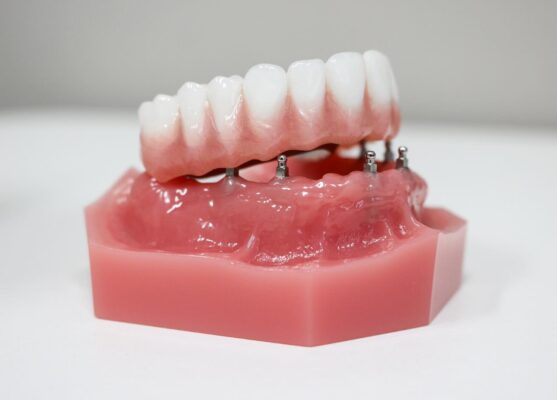 Dentaduras postizas y dentaduras parciales Dentaduras postizas en Southfield, Míchigan