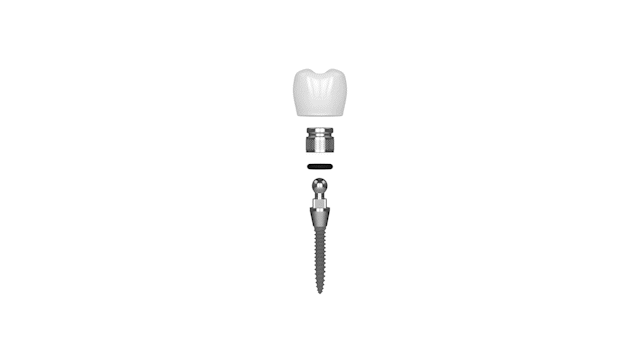 Mini Dental Implants in Southfield, MI | Restore Your Smile Affordably