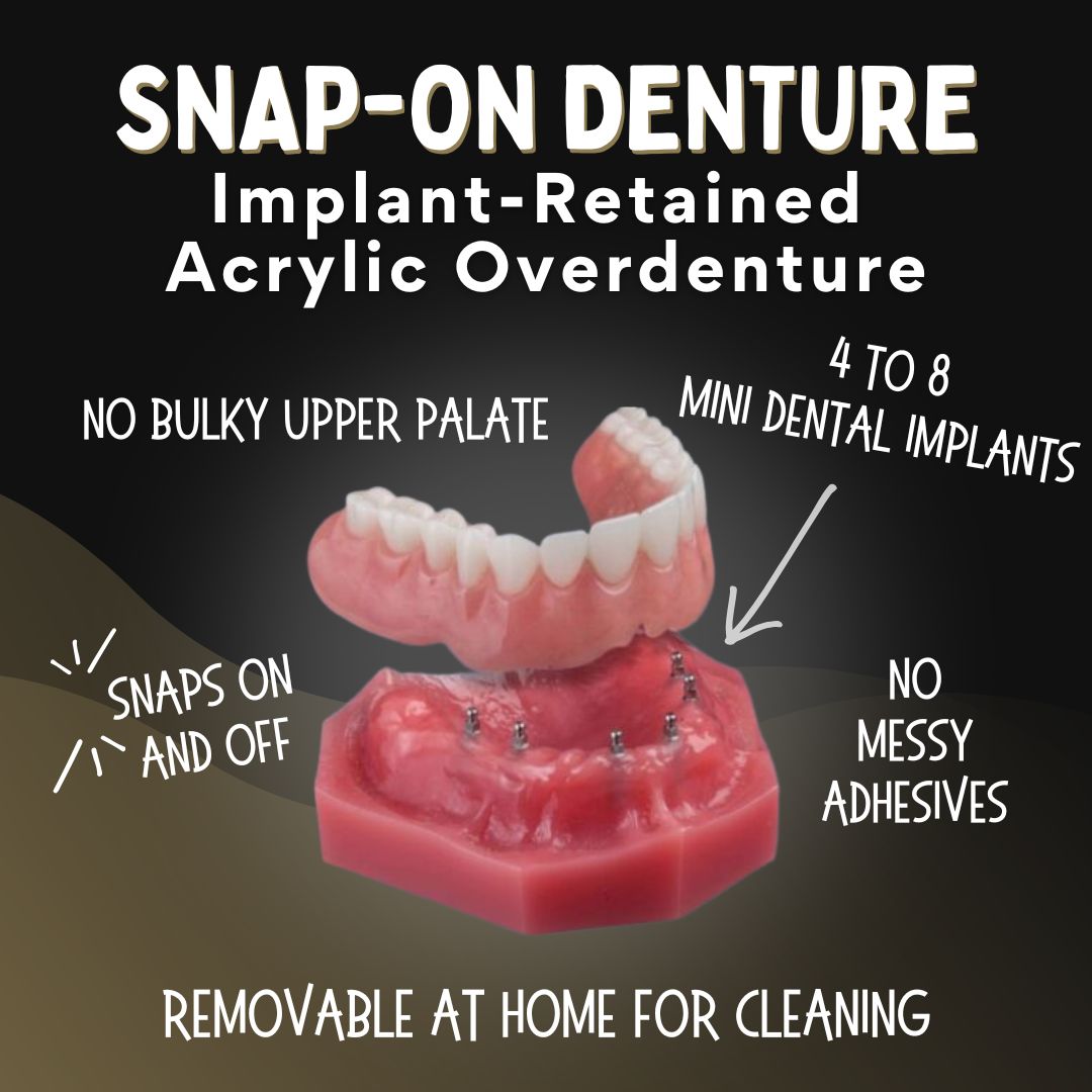 Snap-On Denture in Southfield, MI