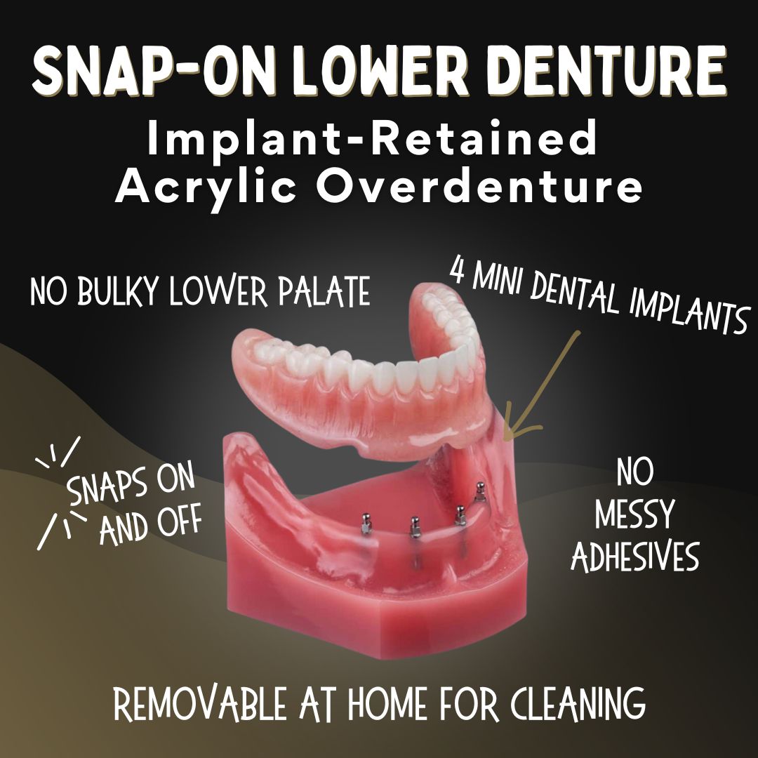 Snap-On Lower Denture in Southfield, MI