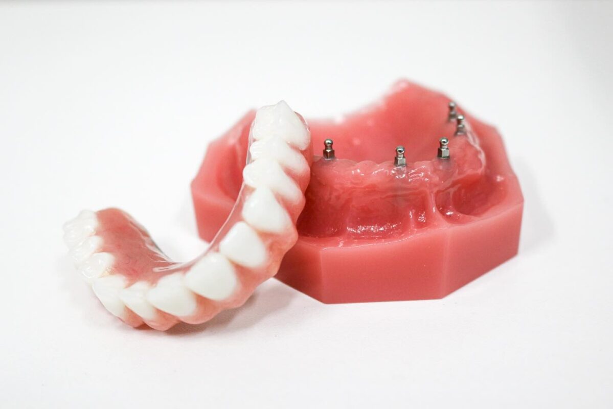 Loose Dentures Solutions in Southfield, MI | Free Consultations