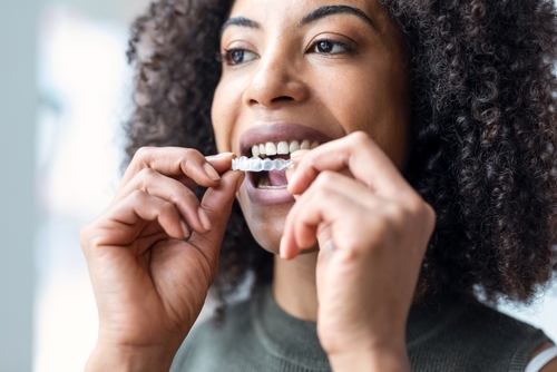Invisalign Alternative in Southfield, MI | Book a Free Consultation!