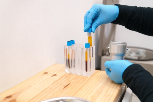 L-PRF in Southfield, MI [Video Breakdown] Accelerate Your Healing