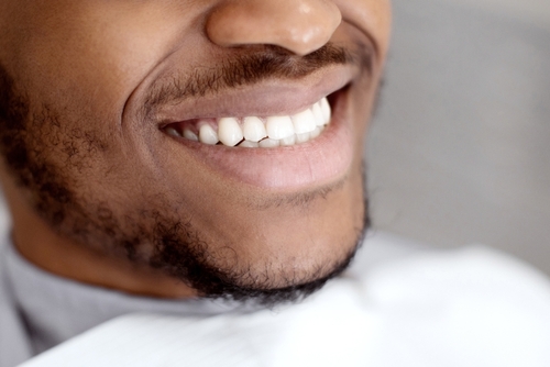 Professional Teeth Whitening in Southfield, MI | Free Consultations
