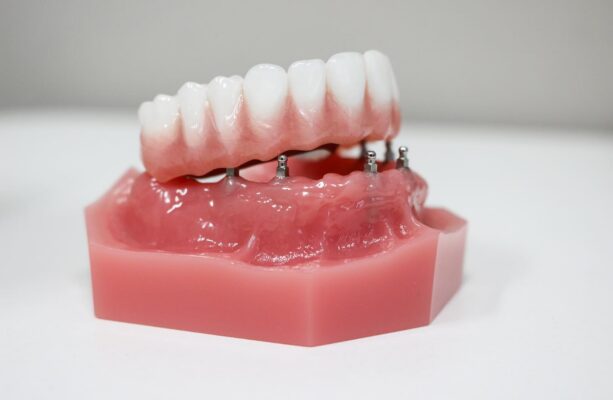 Denture Options in Southfield, MI [Video Guide] Free Consultations