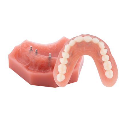 Denture Alternatives in Southfield, MI | Book a Free Consultation!