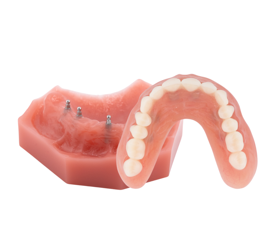 Alternativas a las dentaduras postizas en Southfield, MI | ¡Reserva una consulta gratuita!