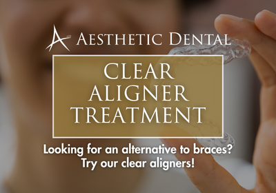 Braces Alternatives in Southfield, MI | Book a Free Consultation