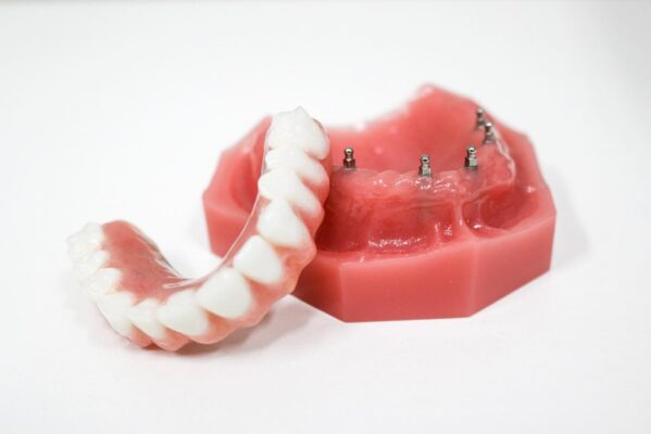 Fix-on-Six in Southfield, MI | Restore Your Smile With Mini Implants