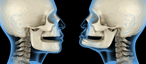 Implantes dentales para toda la boca en Sterling Heights, MI | Consultas gratuitas