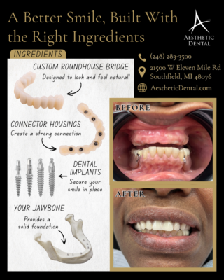 Implantes dentales para toda la boca en Sterling Heights, MI | Cómo los puentes Roundhouse te devuelven la sonrisa