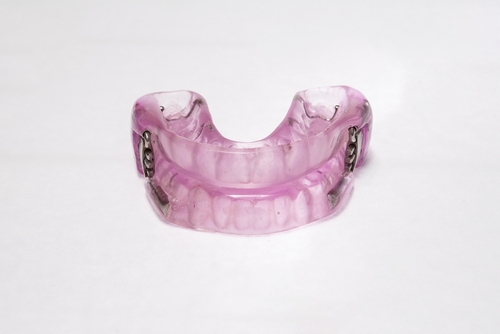 Sleep Apnea Mouth Guard in Southfield, MI | Book a Free Consultation Today!